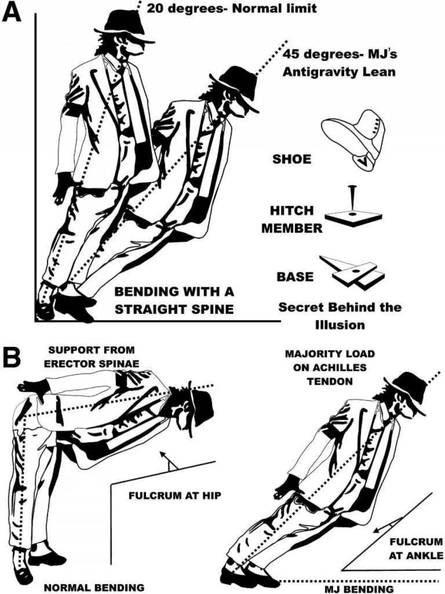 Die Grafik zeigt, wie weit sich Normalsterbliche nach vorne neigen können. Und wie der King of Pop dieses allzu weltliche Problem überwindet. Bild: Manjul Tripathi, Journal of Neurosurgery