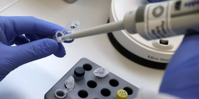 Auswertung eines Covid-19-Tests in einem Labor. (Symbolbild) coronavirus