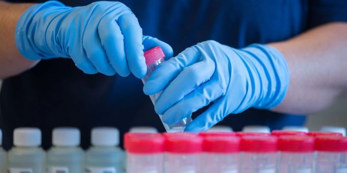 Mangelnde Nachfrage - Wacker Chemie stapelt dieses Jahr tiefer
