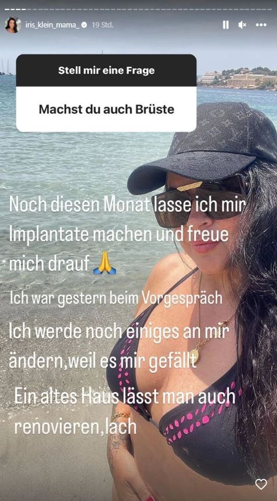 Iris Klein will sich die Brüste machen lassen.