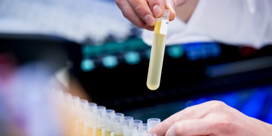 Die Polizei hat in Pratteln BL 3200 Injektionsflaschen mit illegal importierten Peptiden gefunden. Wer solche Produkte im Sport anwendet, riskiert einen Verstoss gegen Anti-Doping-Besti...