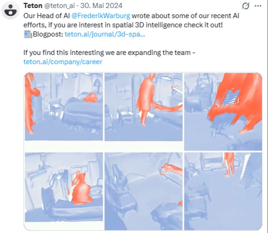 Das System der Firma Teton nutzt KI fürs Patientenmonitoring.