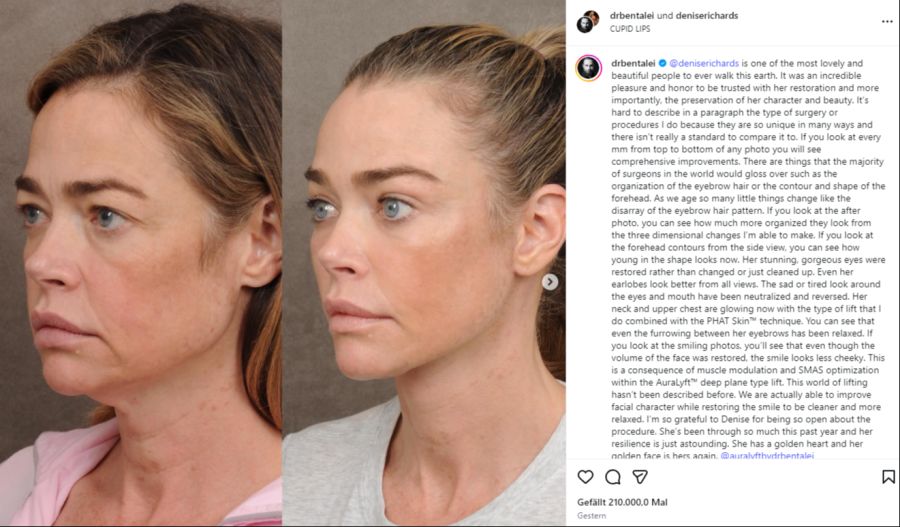 Auch von der Seite ist ein deutlicher Unterschied zu sehen.