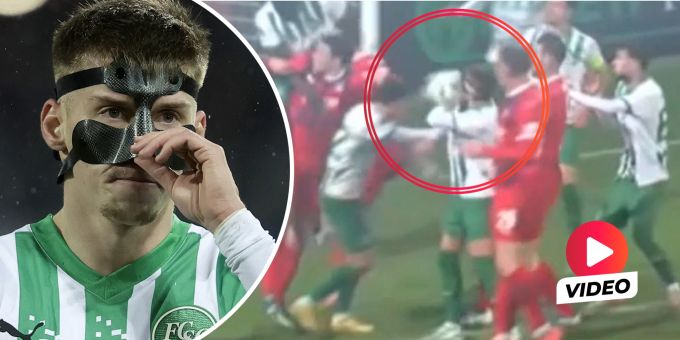 Autsch! - FCSG-Star spielt mit Nasenbruch – und kriegt Ball ins Gesicht