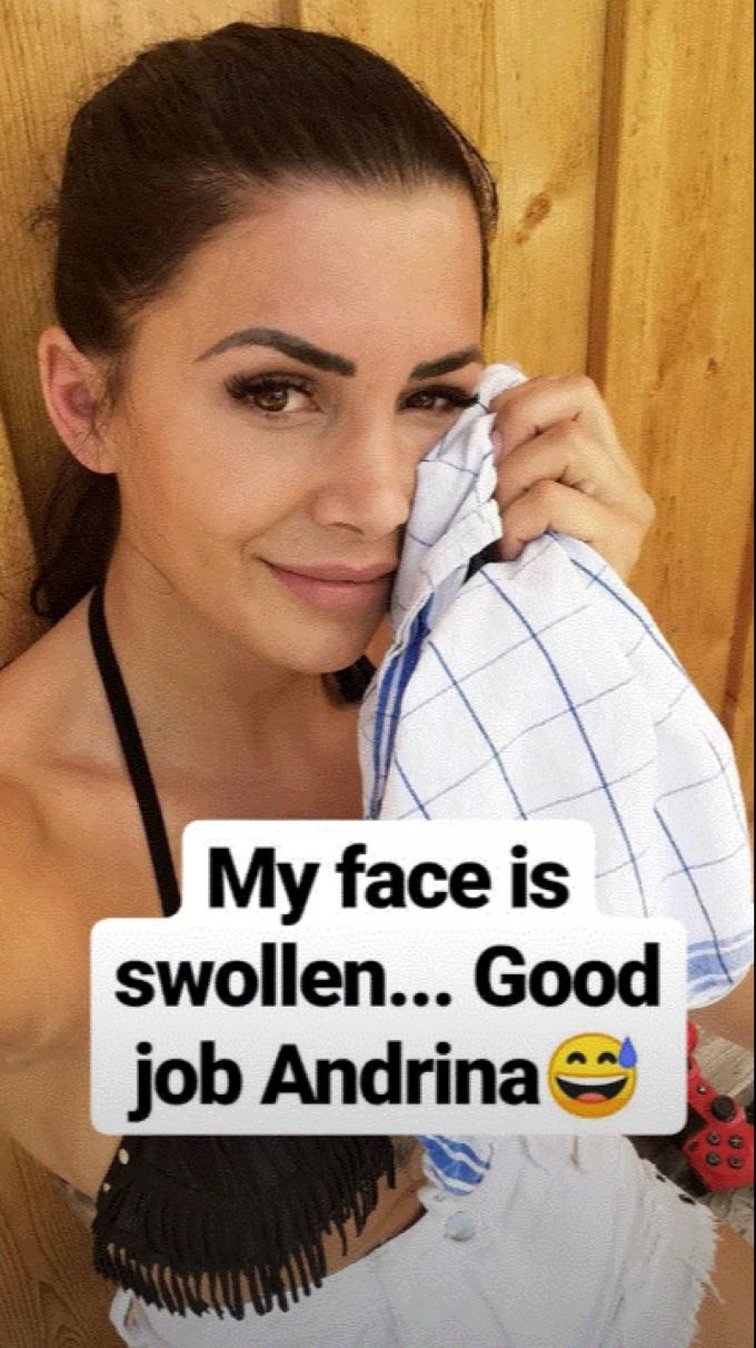 Bachelorette Andrina Santoro fällt beim Baden voll aufs Gesicht