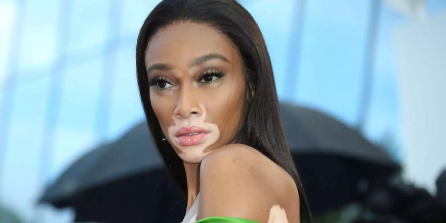 Es war wohl ein Kommunikationsfehler, der zur Panne von Winnie Harlow geführt hat.