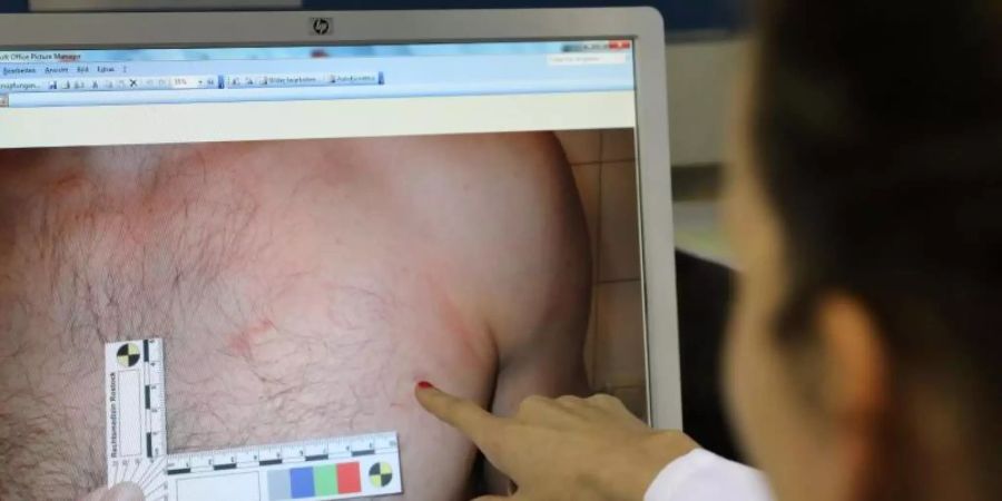 Im Untersuchungsraum der Opferambulanz am Institut für Rechtsmedizin zeigt eine Assistenzärztin den dokumentierten Fall einer Verletzung bei einem Mann. Foto: Bernd Wüstneck/dpa