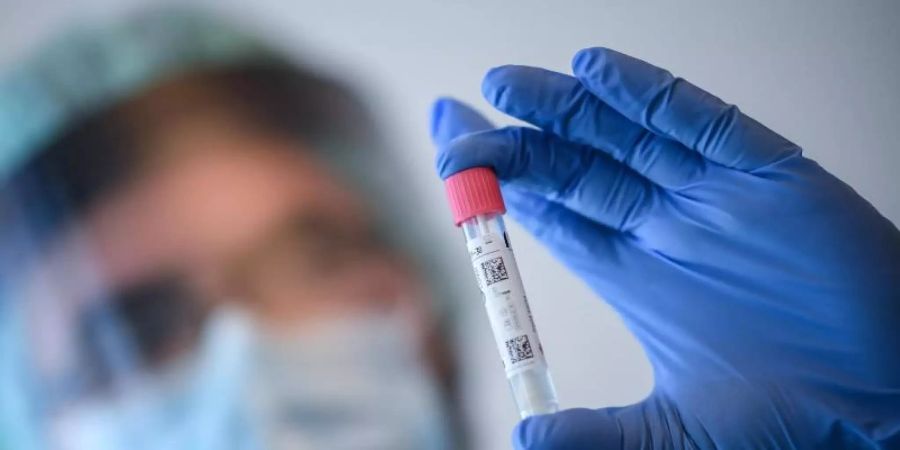 Ein Arzt nimmt in der Corona-Teststelle am Flughafen Schönefeld einen Abstrich für einen Coronavirus-Test. Foto: Britta Pedersen/dpa-Zentralbild/dpa