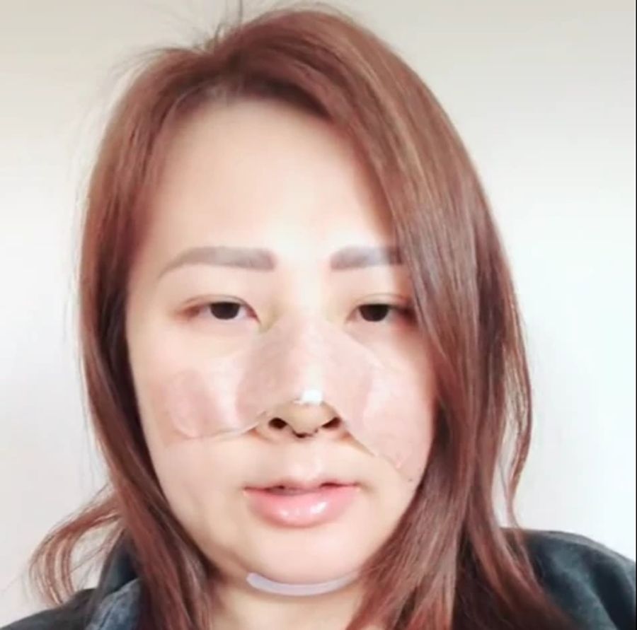yen