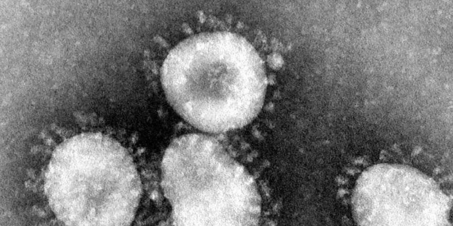 Ganz nah: Ein Coronavirus unter einem Mikroskop. Foto: Center for Disease Control/epa/dpa