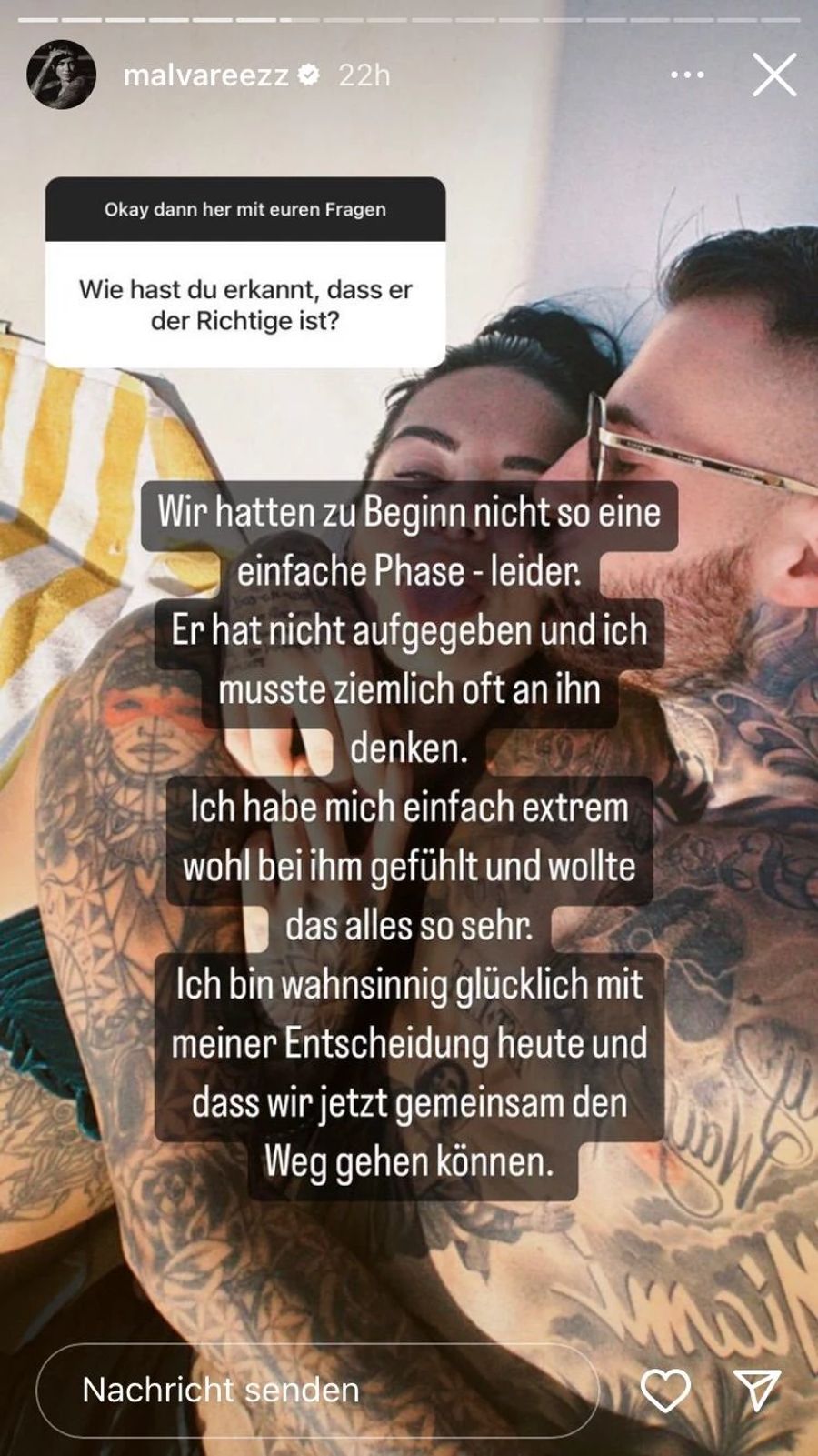 Das Model beantwortet die brennenden Fragen ihrer Fans in ihrer Instagram-Story.