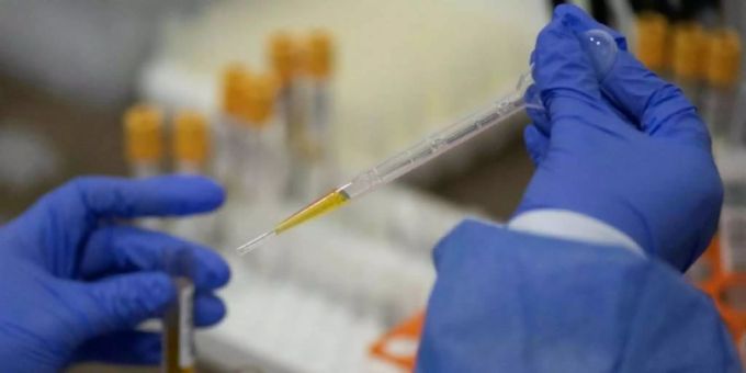 In den USA wird bereits eine Notfallzulassung des Impfstoffes von Johnson & Johnson gegen das Coronavirus geprüft. Coronavirus Impfung