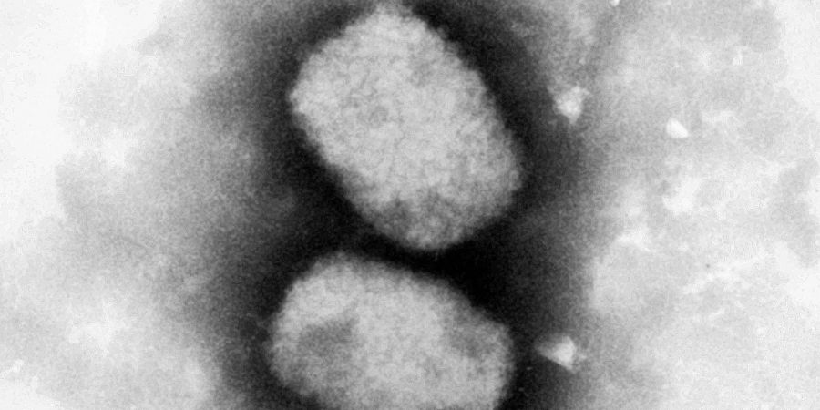 Nach dem Auftreten erster Fälle von Affenpocken in Deutschland sehen Fachärzte keine neue Pandemie aufziehen.