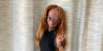 Adalia Rose Williams