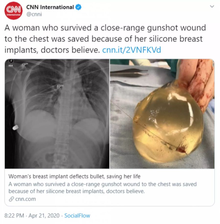 implantat