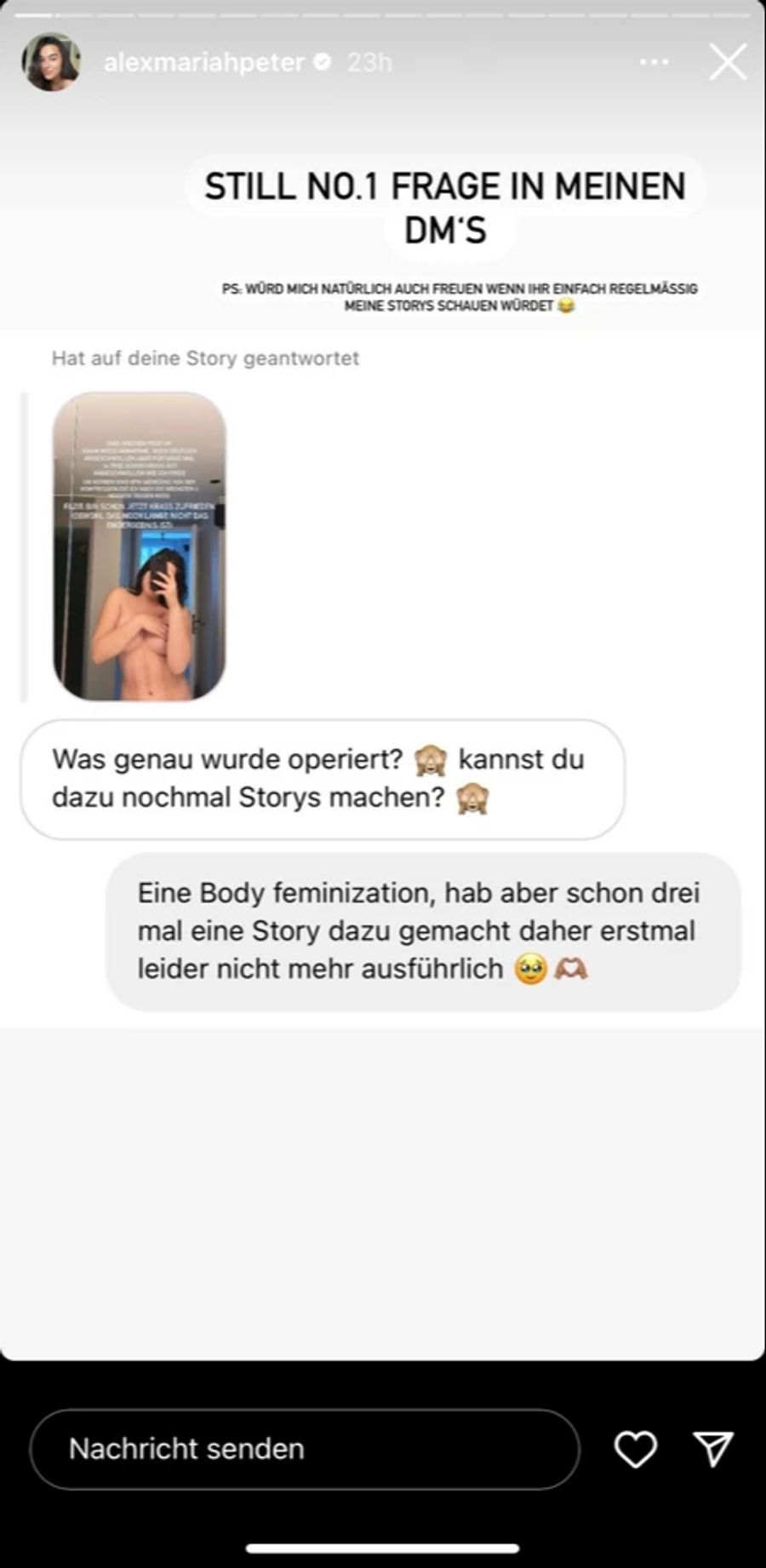 Die «GNTM»-Siegerin will ihren Körper weiblicher machen.