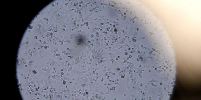 geruchsverust corona infektion