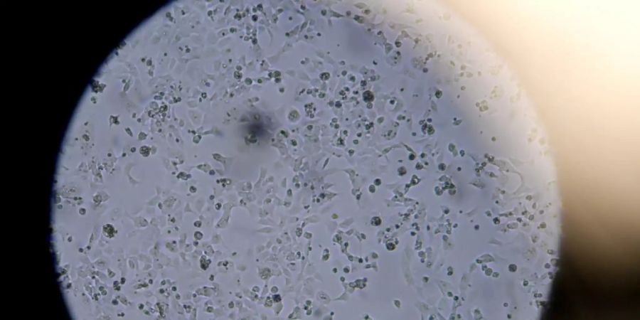 geruchsverust corona infektion