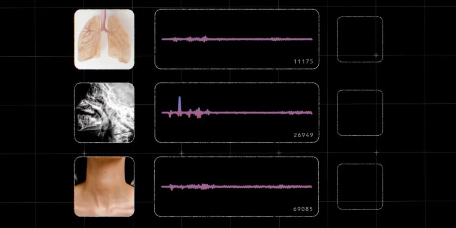 Akustikaufzeichnungen Lungenbilder