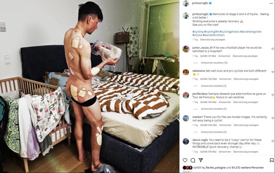 Primoz Roglic zeigt seine Wunden.