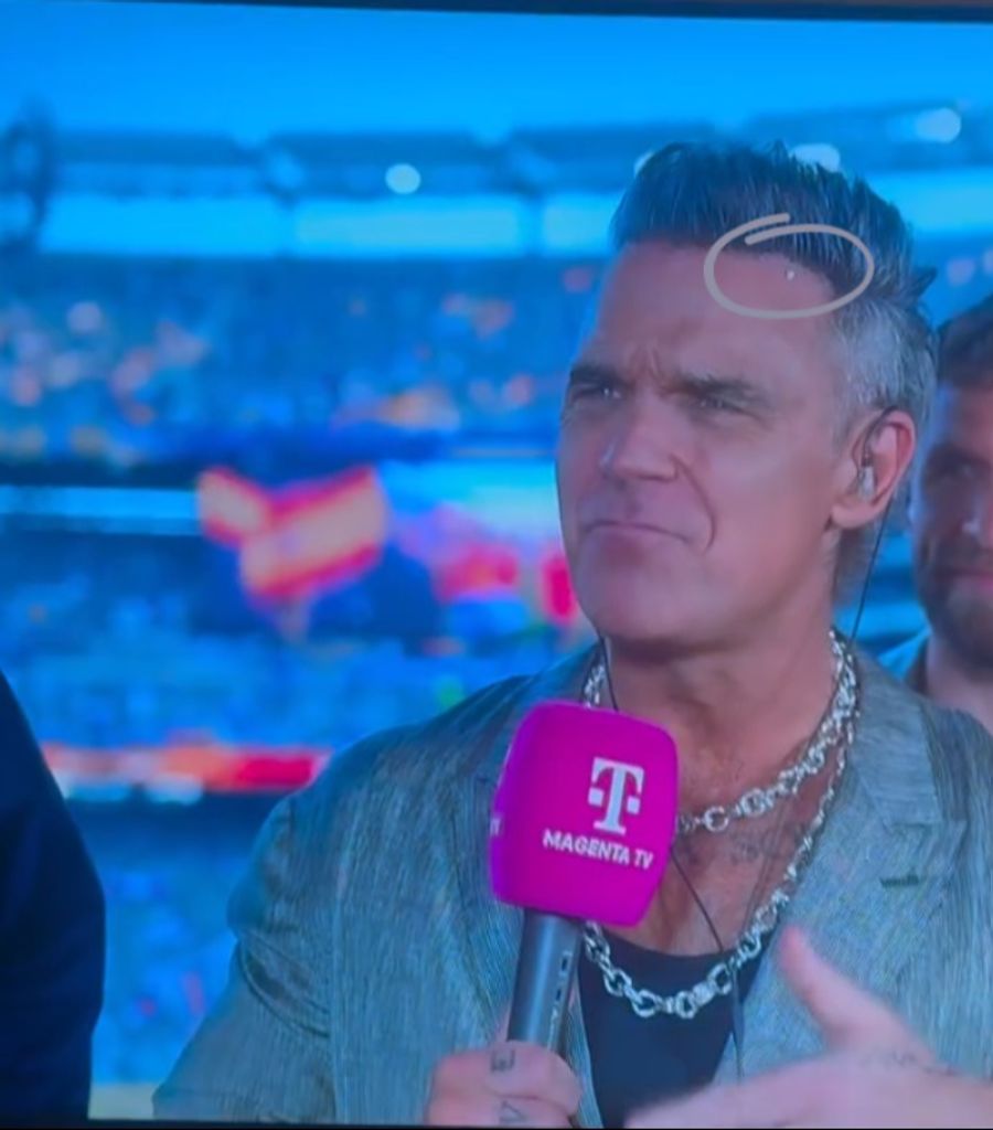Beim Wegwischen klebt es plötzlich an der Stirn von Robbie Williams. Später erklärt er, es sei eine Pfefferminzpastille gewesen.