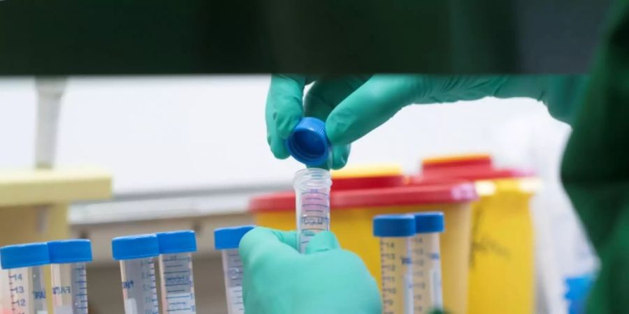 Coronavirus-Test in einem Labor in Stuttgart
