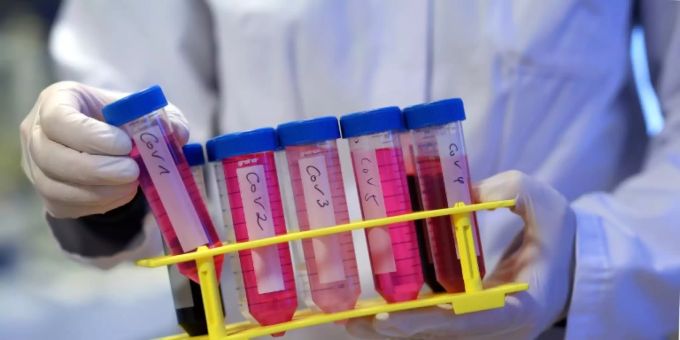 Untersuchung von Proben des Coronavirus an der Uniklinik Magdeburg. coronavirus