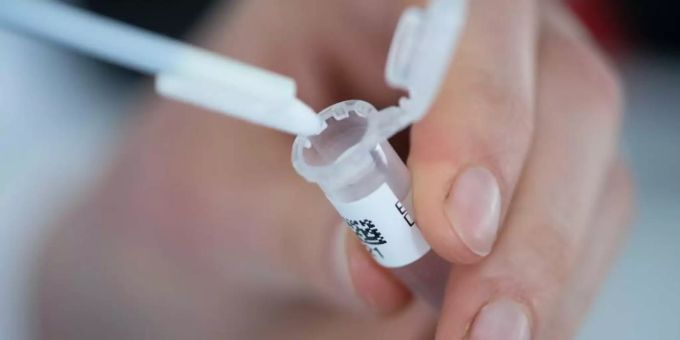 Berlin - Hautfarbe und Alter: Stärkere DNA-Auswertung geplant