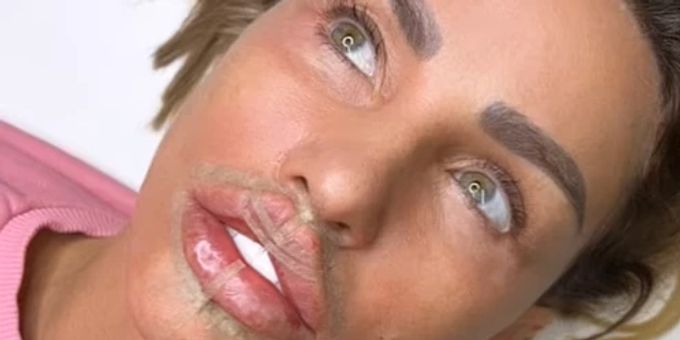 «Liebe es» - Briten-Star Katie Price zeigt ihre neuen XL-Lippen