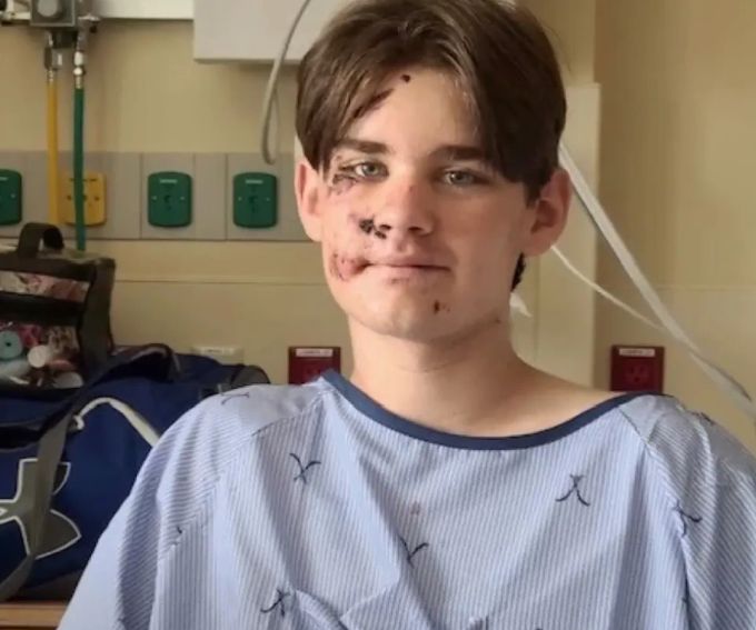 Wyatt Kauffman überlebte einen 30-Meter-Sturz. Er wurde bereits wieder aus dem Spital entlassen. 30-Meter-Sturz