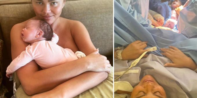 Krasses Bild - So dementiert Chrissy Teigen Gerüchte um Fake-Babybauch