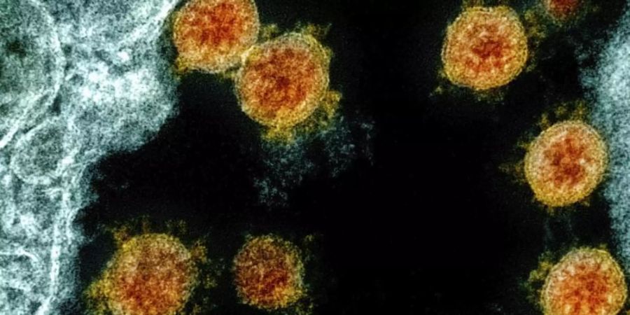 Diese elektronenmikroskopische Aufnahme aus dem Jahr 2020 wurde farblich bearbeitet und zeigt Partikel des Coronavirus SARS-CoV-2. Foto: Uncredited/NIAID/NIH/dpa