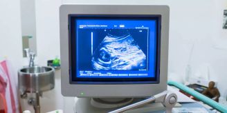 Schmutzige Luft - Forscher finden Russpartikel in Organen von Embryos