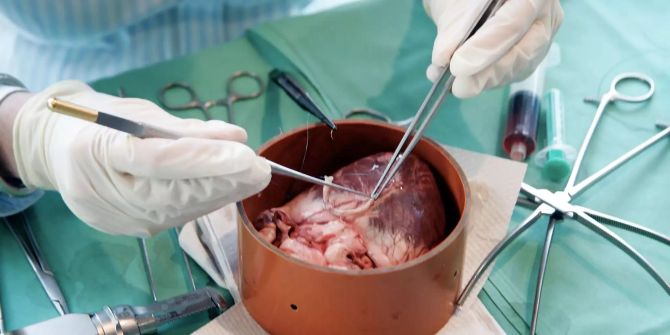 Mit mikrochirurgischen Instrumenten wird an einem Schweineherz in der Uniklinik in Frankfurt am Main (D) operiert.