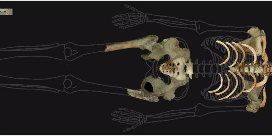 Überreste des Skeletts, das im Wald gefunden wurde. Bild: Scientific Reports