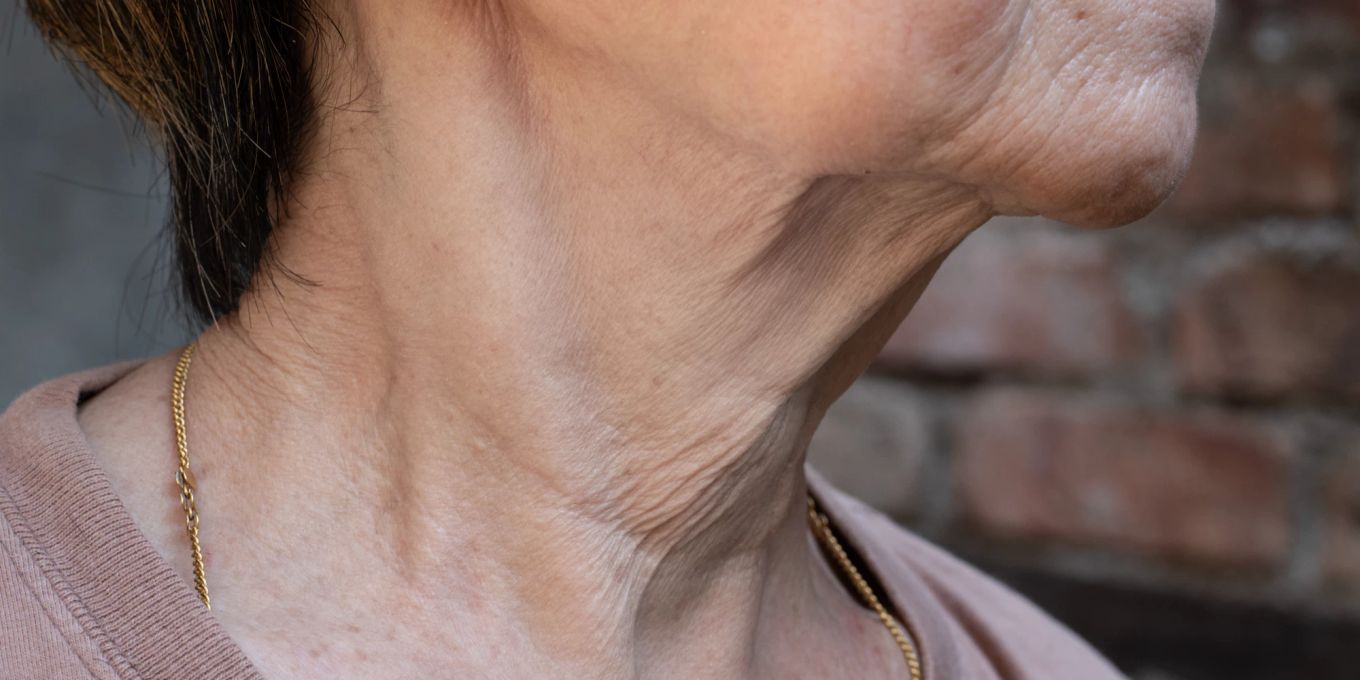 Schnelle Tipps gegen schlaffe Haut am Hals | Nau Beauty