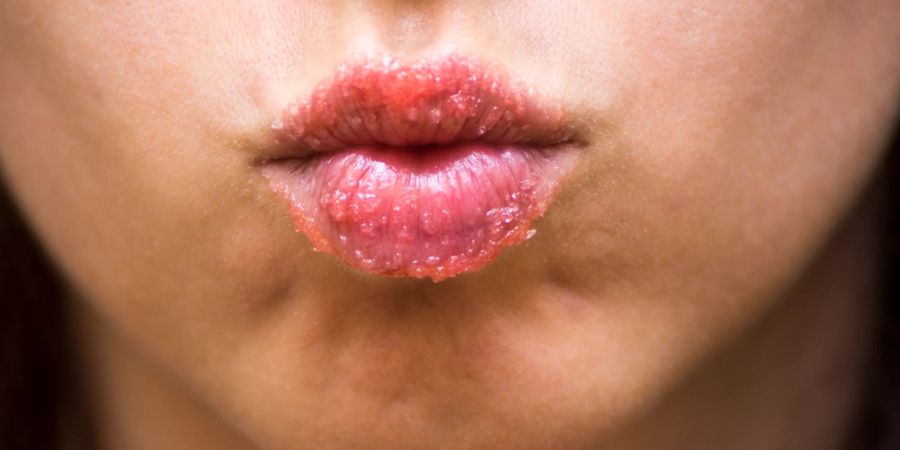 Ein Lippenpeeling sorgt dafür, dass die Haut auch im Alter weich bleibt.
