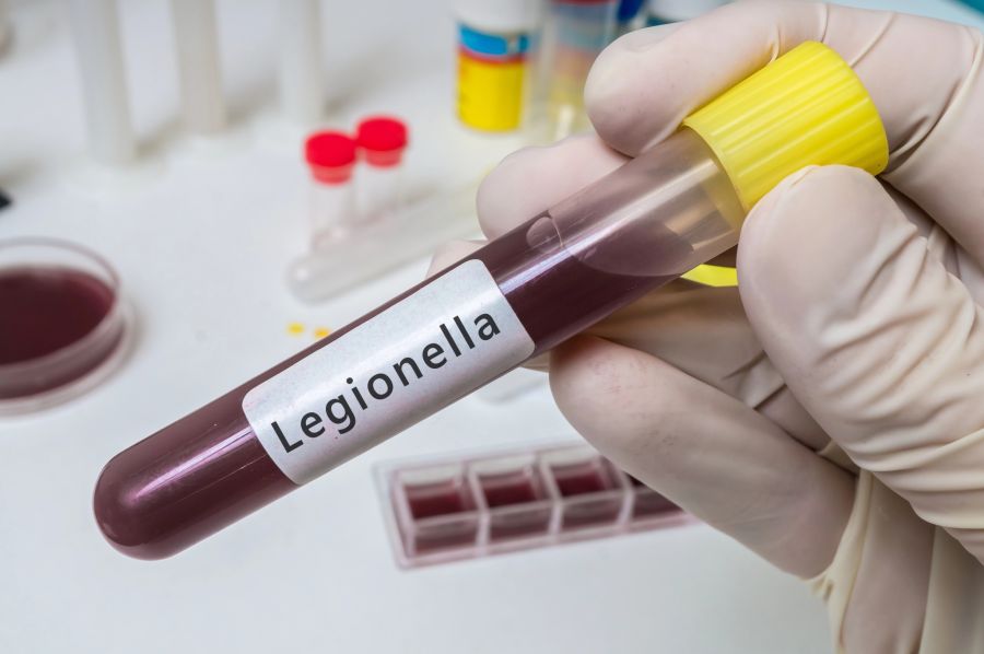 legionellen im reagenzglas