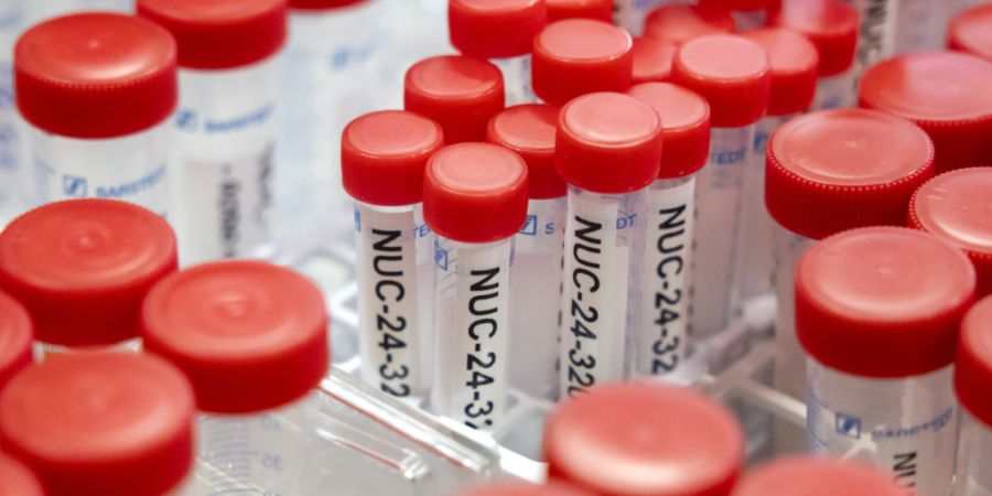 Die Stadt Luzern macht im Gebiet Würzenbach, zwischen der Lidostrasse und der Kreuzbuchstrasse, verschiedene Altlastenuntersuchungen. (Symbolbild)