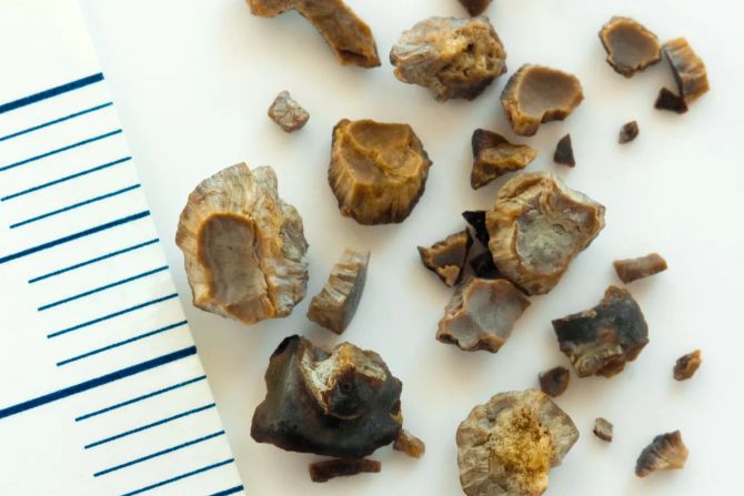 Zentimeter Lineal Steinchen