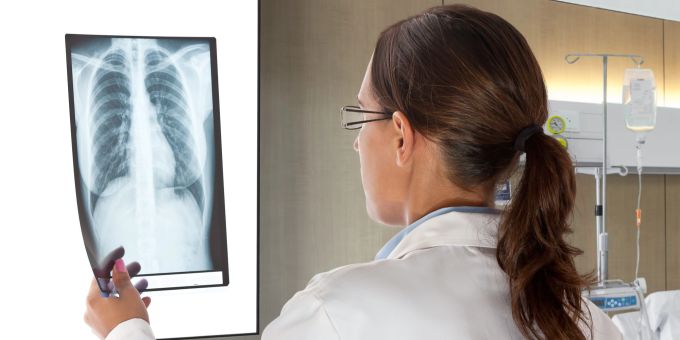 Frauengesundheit - Wie können Frauen ihre Knochengesundheit fördern?