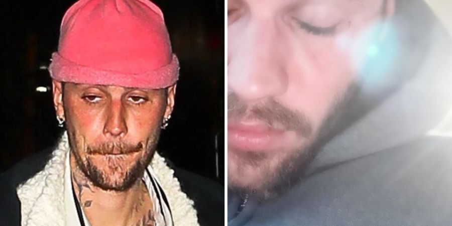 Fans sorgen sich schon länger um Justin Bieber.