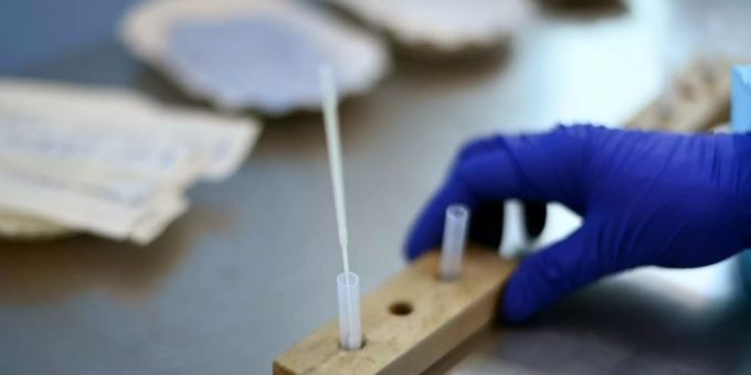 Corona-Schnelltest Corona-Schnelltest