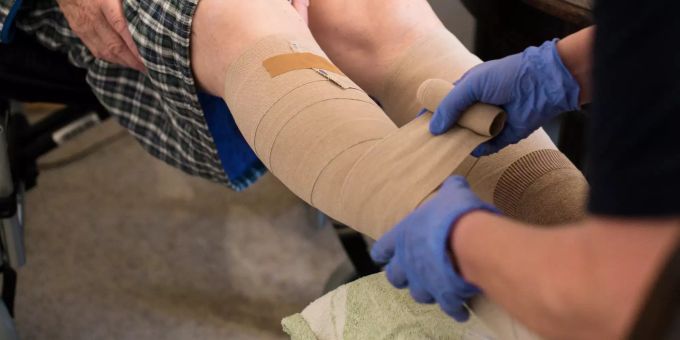 Eine ambulante Pflegerin bandagiert die Beine eines alten Mannes. schweizer personal