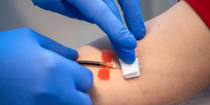 Studien zufolge kann die Antikörper-Therapie einen schweren Verlauf bis zu mehr als 80 Prozent verhindern. Foto: Sina Schuldt/dpa Studien zufolge kann die Antikörper-Therapie einen schweren Verlauf bis zu mehr als 80 Prozent verhindern. Foto: Sina Schuldt/dpa