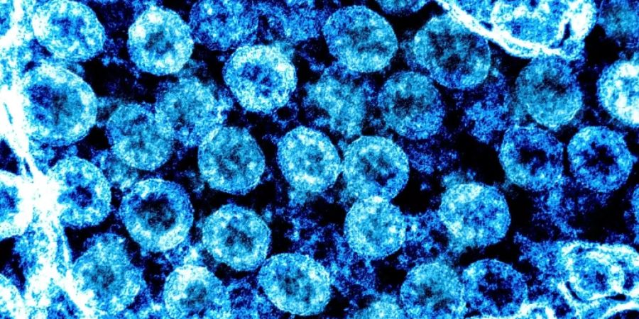 coronavirus