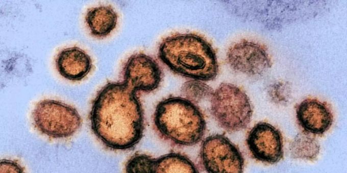 Das Coronavirus unter dem Mikroskop. Es überlebt gemäss neusten Erkenntnissen mehrere Monate in unseren Organen. Virologe Streeck