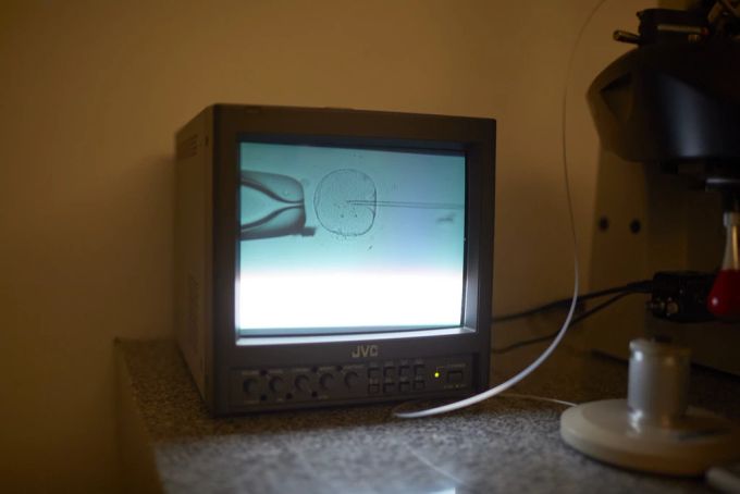 Eizellspende künstliche Befruchtung