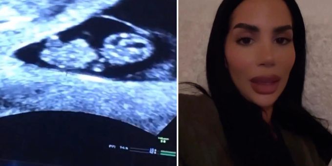 «Mein Sohn lächelte» - «Bachelor»-Mia spricht über ihre Fehlgeburt