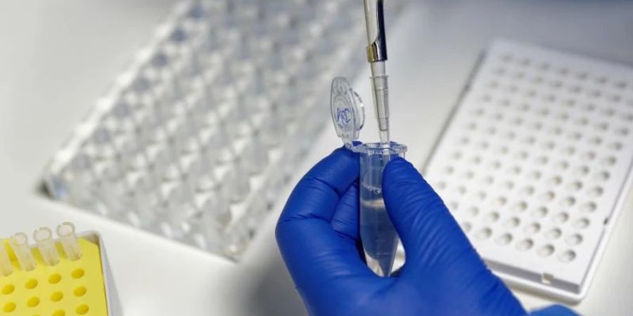 Eine Mitarbeiterin des Labors CBT füllt mit einer Pipette, zur Vorbereitung von PCR-Tests, eine Testflüssigkeit ein. Foto: Henning Kaiser/dpa